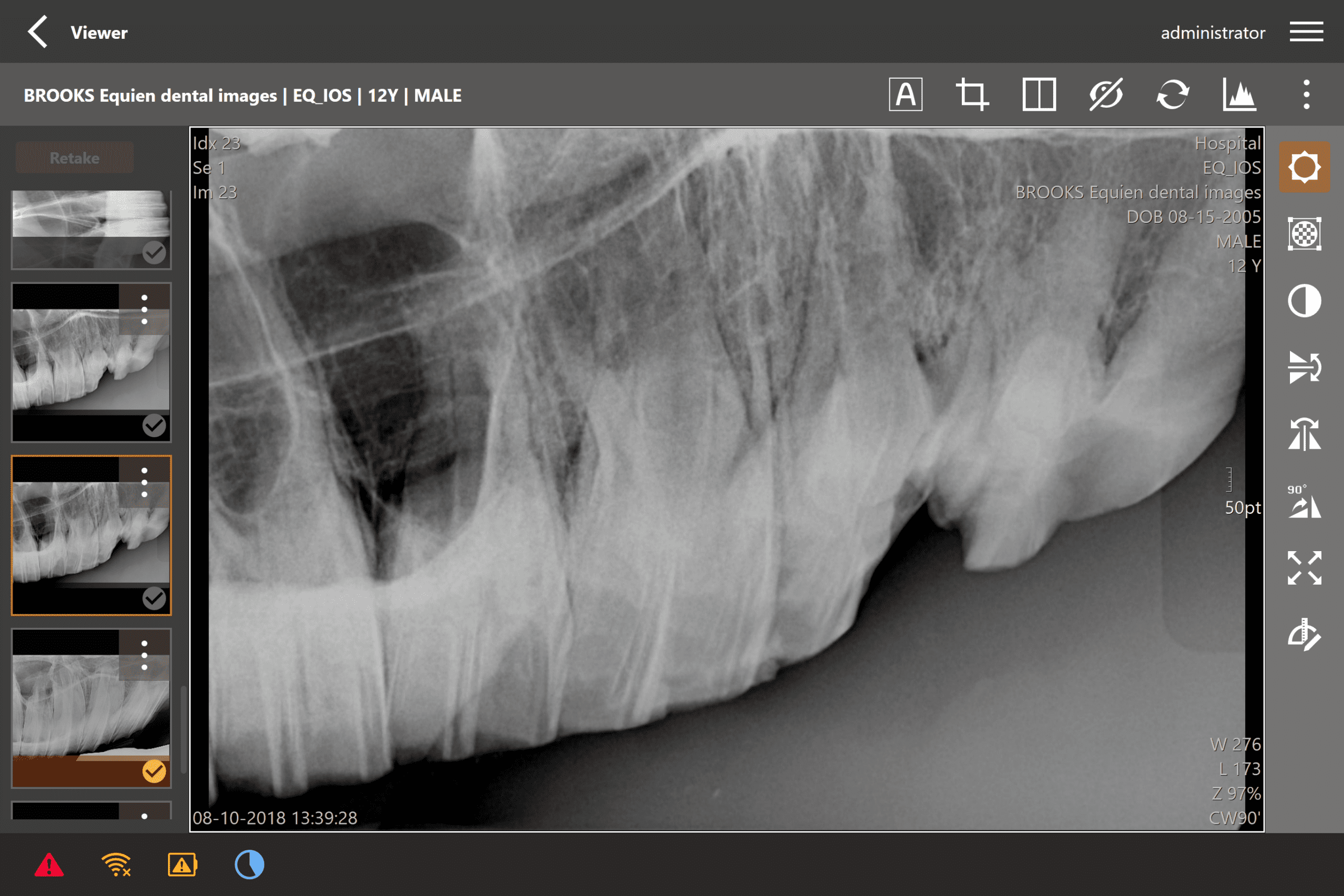 The Practical Applications of the Digital Dental X-Ray