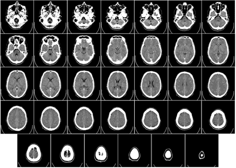 What Is The Difference Between An Mri Ct Scan In Mi Great Lakes Imaging