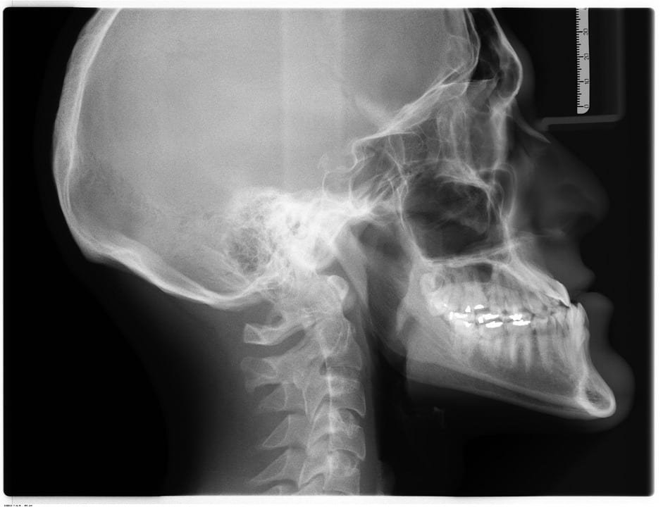 Lifespan of Your X-Ray Equipment