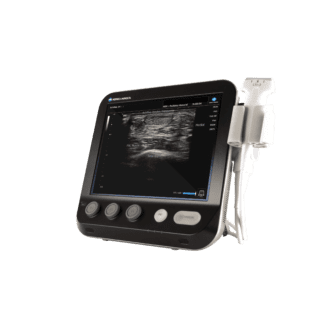 Ultrasound