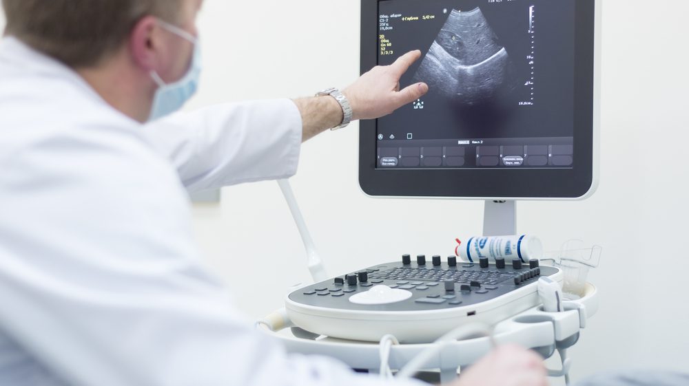 ultrasound equipment