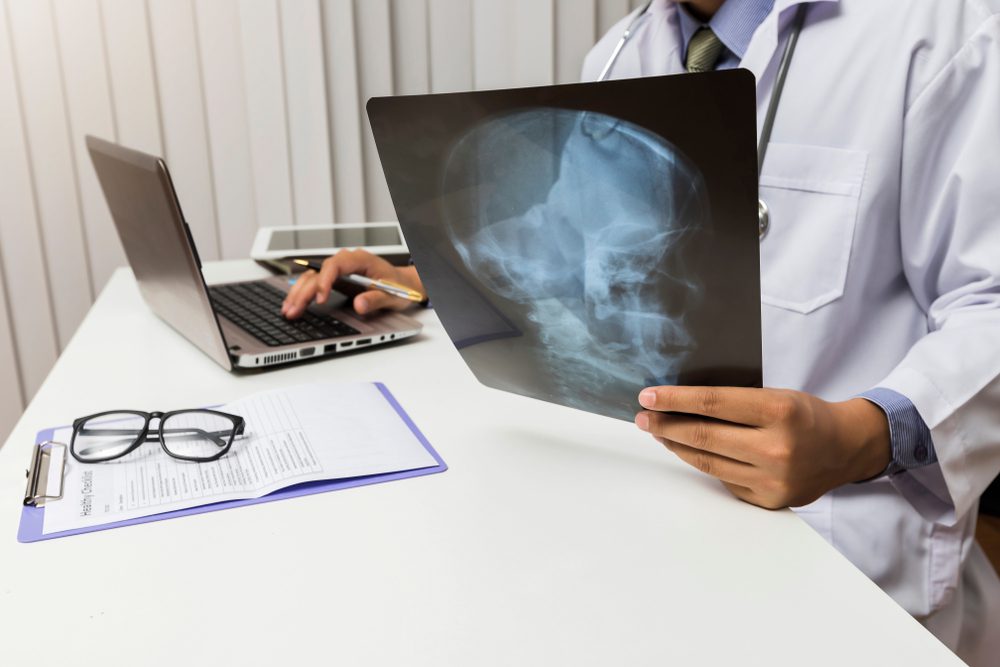 Digital X Rays in Emergency Medicine: Providing Rapid and Accurate Diagnosis for Critical Conditions