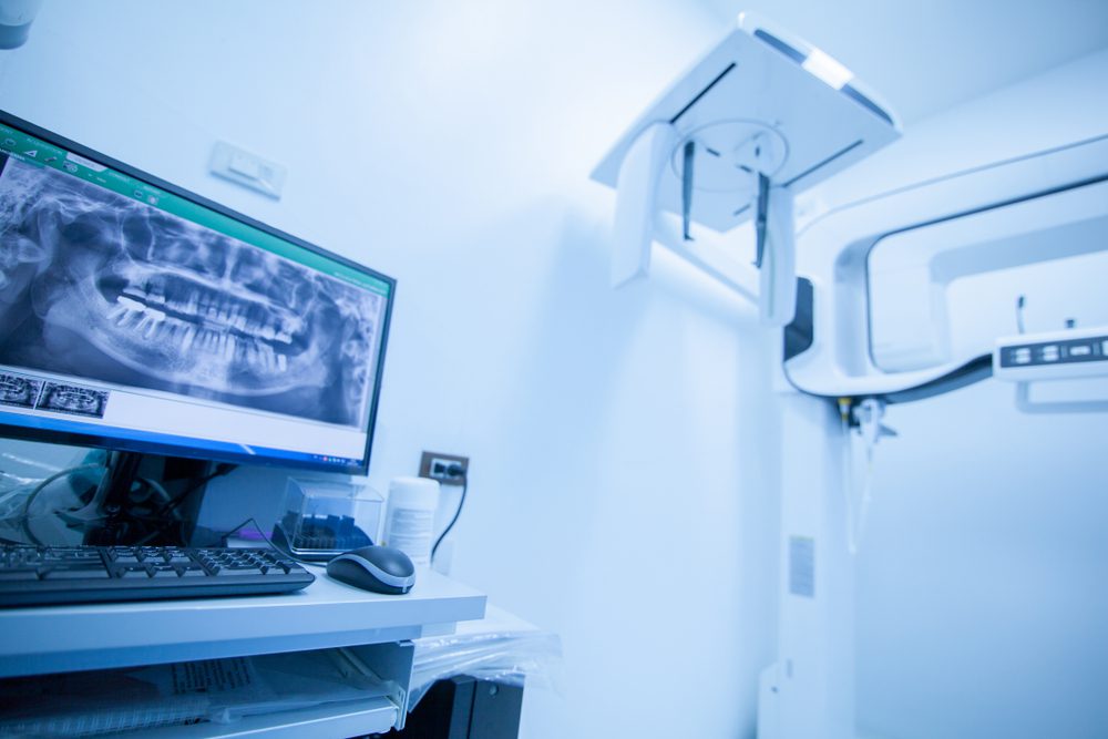 digital x ray machine showing dental results