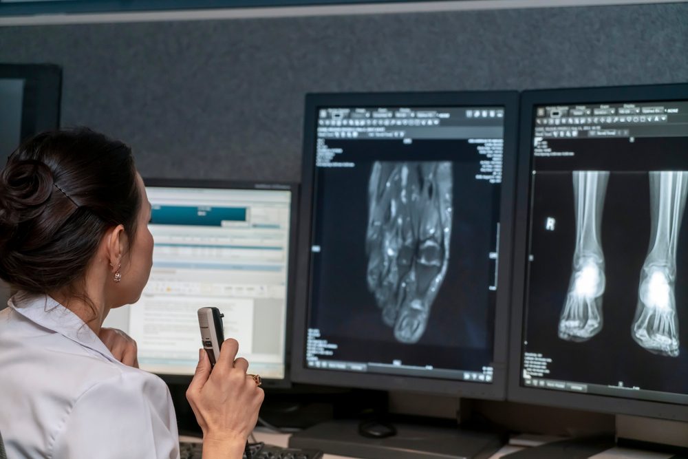 The Advantages of Digital Motion X-ray Technology